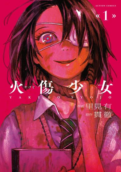 火伤少女 封面