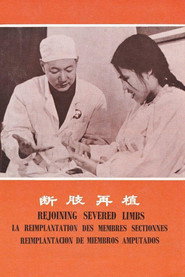 断肢再植 封面