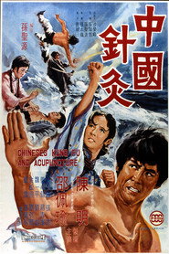 中國針灸 封面