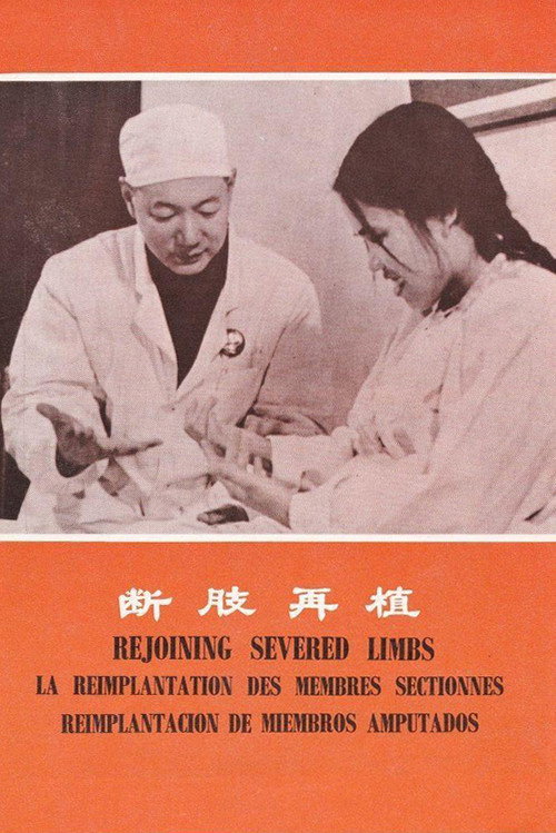 断肢再植 封面